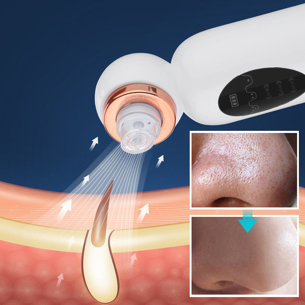nordivo | Hudrensning med hydrodermabrasion til fjernelse af hudorme