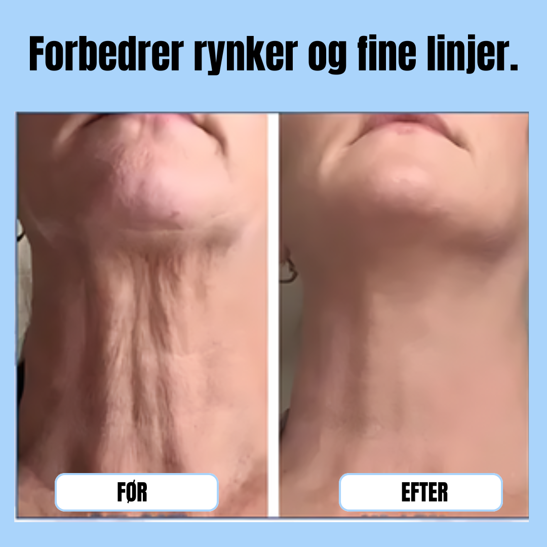 Få strammere hud uden besvær – mærk forvandlingen med det samme!
