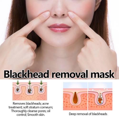 Peel-off maske mod hudorme