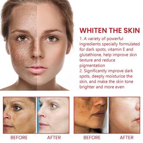 Creme mod pigmentpletter med jojoba og vitamin E
