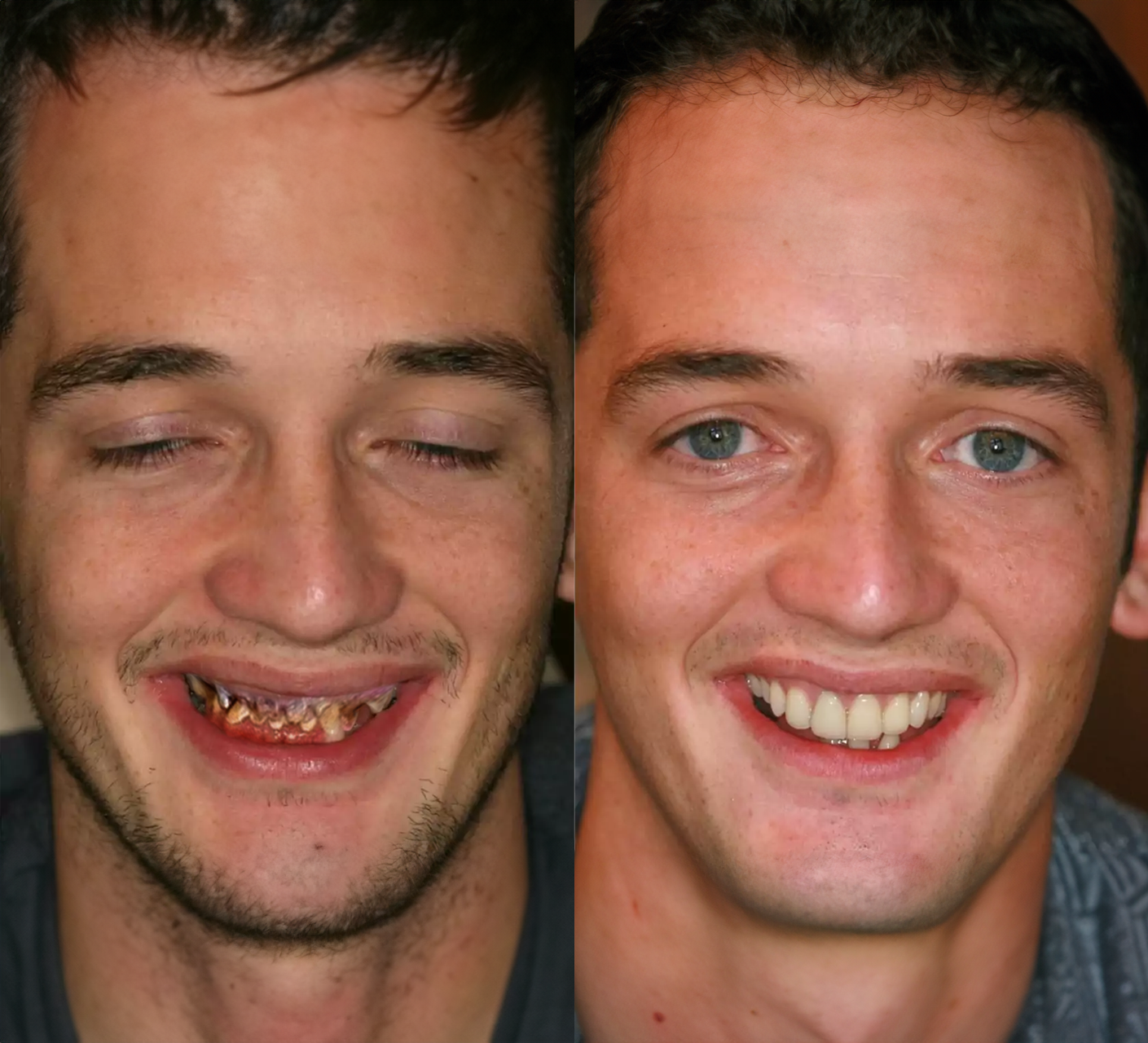 Beskyt & Styrk Dine Tænder