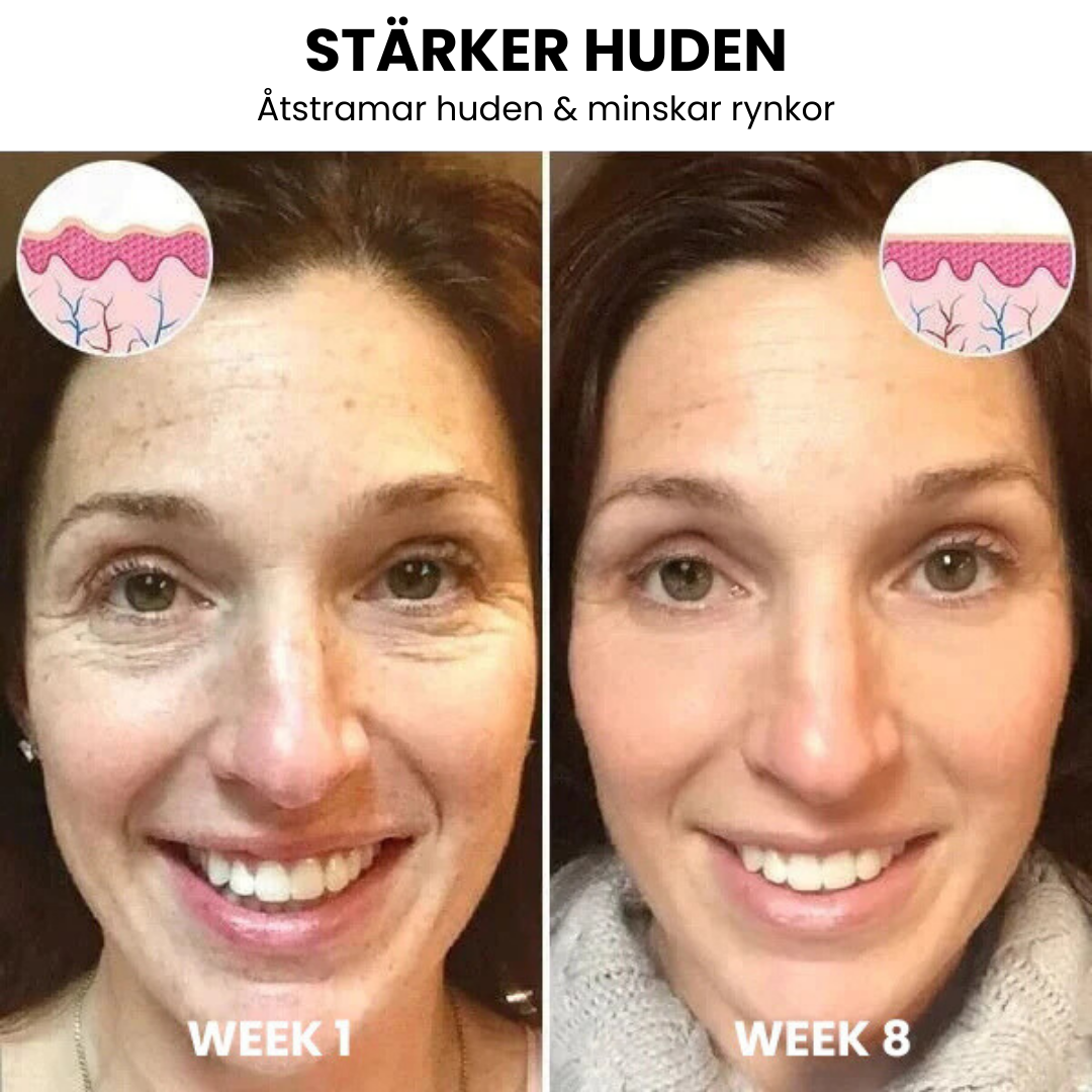 Wrinkle-free skin in just minutes!