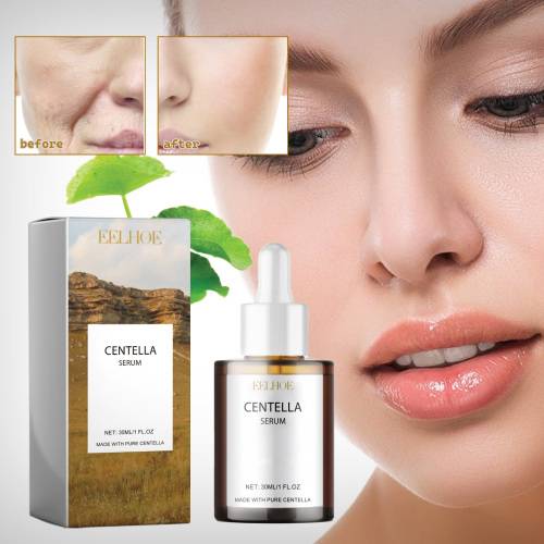 Centella serum med hyaluronsyre