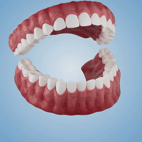 SmileFitPro  – en løsning af den nye generation: Fleksibel helprotes