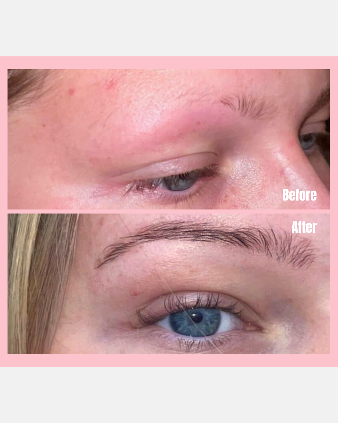 Eyebrow Growth Serum