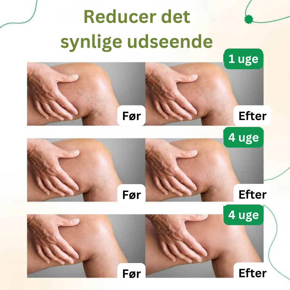Garanteret glattere og sundere ben