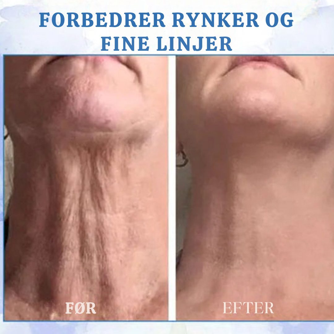 Sig farvel til crepet og slap hud - forvandl dit look!