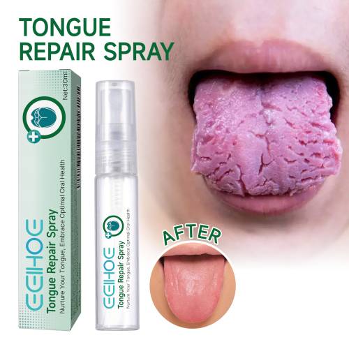 Pebermynte tungespray