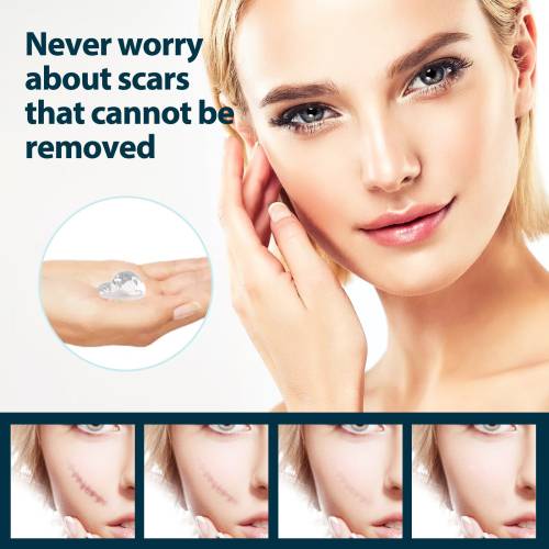 Retinol allantoin hudgel