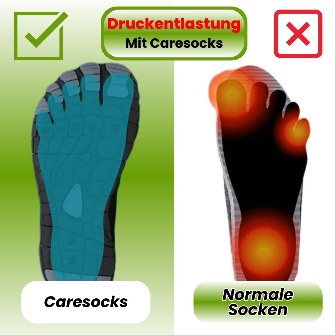Caresocks – Kompressionsstrømper mod åreknuder og tunge ben