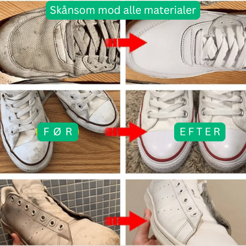 Holder skoene i perfekt stand