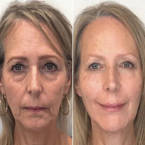 2 drops a day keeps the wrinkle away!