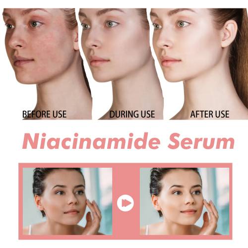 Niacinamid essens for finere porer