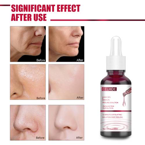 AHA 30% + BHA 2% eksfolierende serum