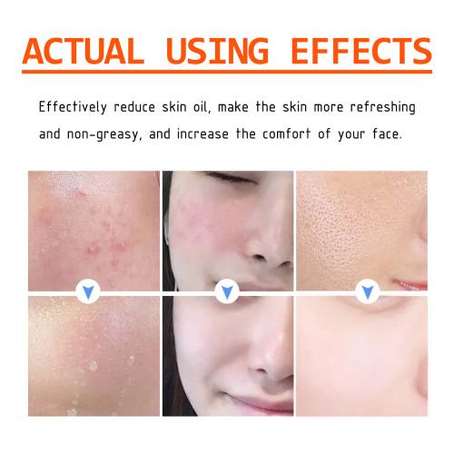 Salicylsyre klarende ansigtsmaske