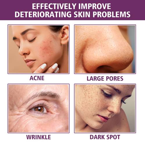 Niacinamid og portulak serum