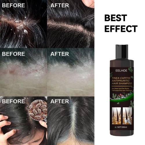 Urte hovedbundsshampoo med bynke og kaprifolie