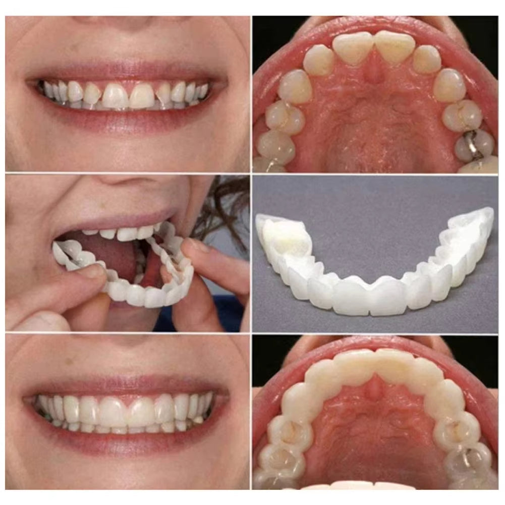 Fejlfrit smil på få minutter